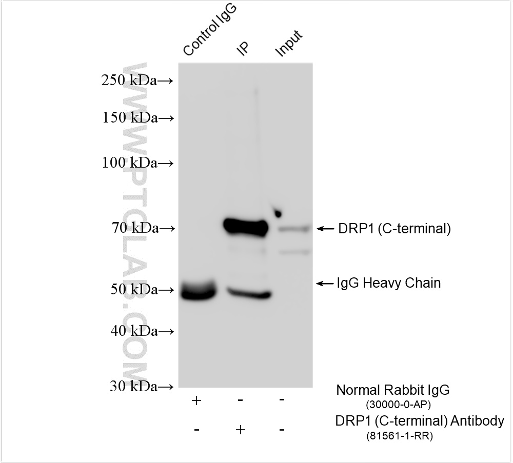 IP experiment of rat brain using 81561-1-RR (same clone as 81561-1-PBS)