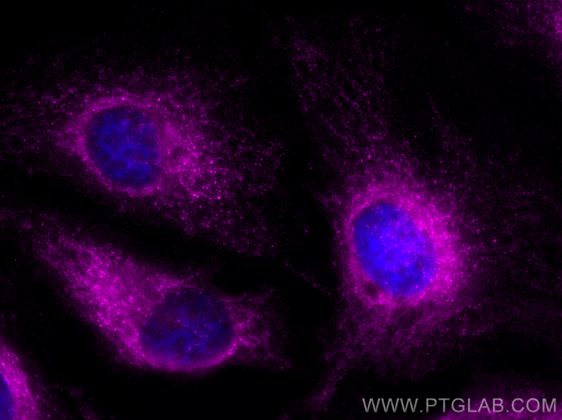 IF Staining of HeLa using CL647-12957