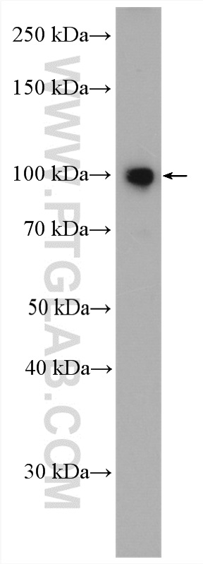 WB analysis of mouse brain using 26631-1-AP