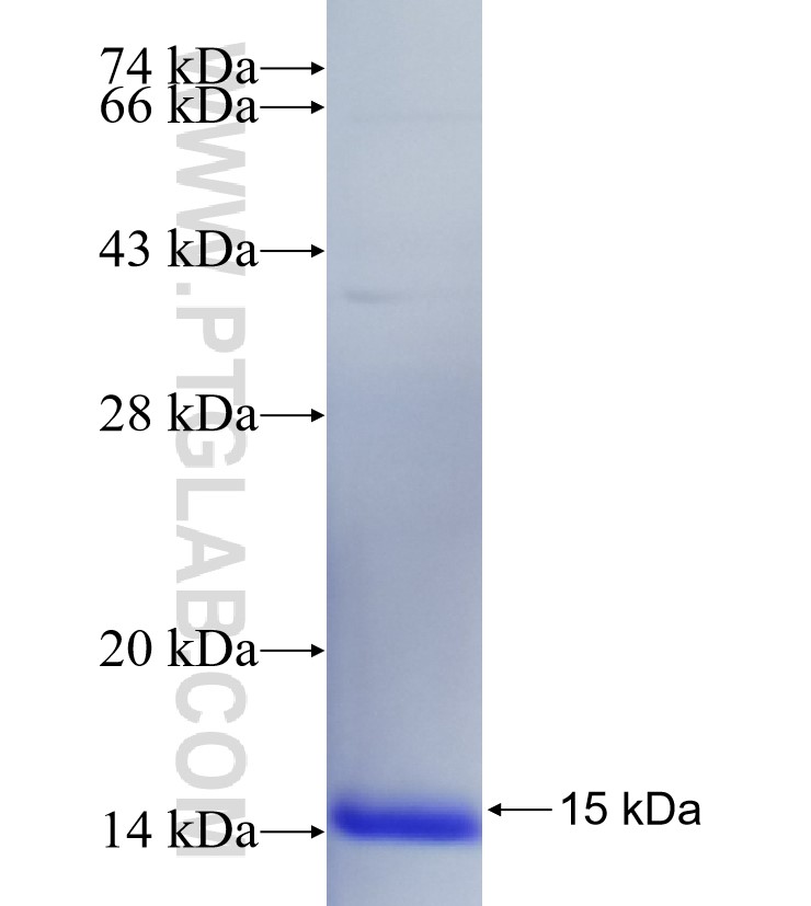 DSC1 fusion protein Ag27015 SDS-PAGE DSC1 fusion protein Ag27015 SDS-PAGE