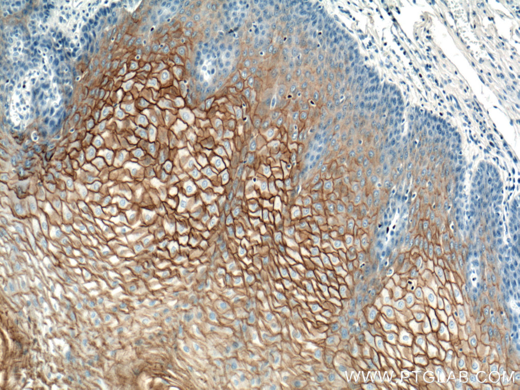 IHC staining of human oesophagus using 13876-1-AP