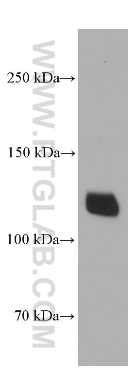 WB analysis of HEK-293 using 60239-1-Ig