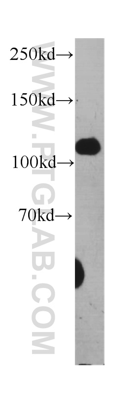 Desmocollin 2 Monoclonal antibody