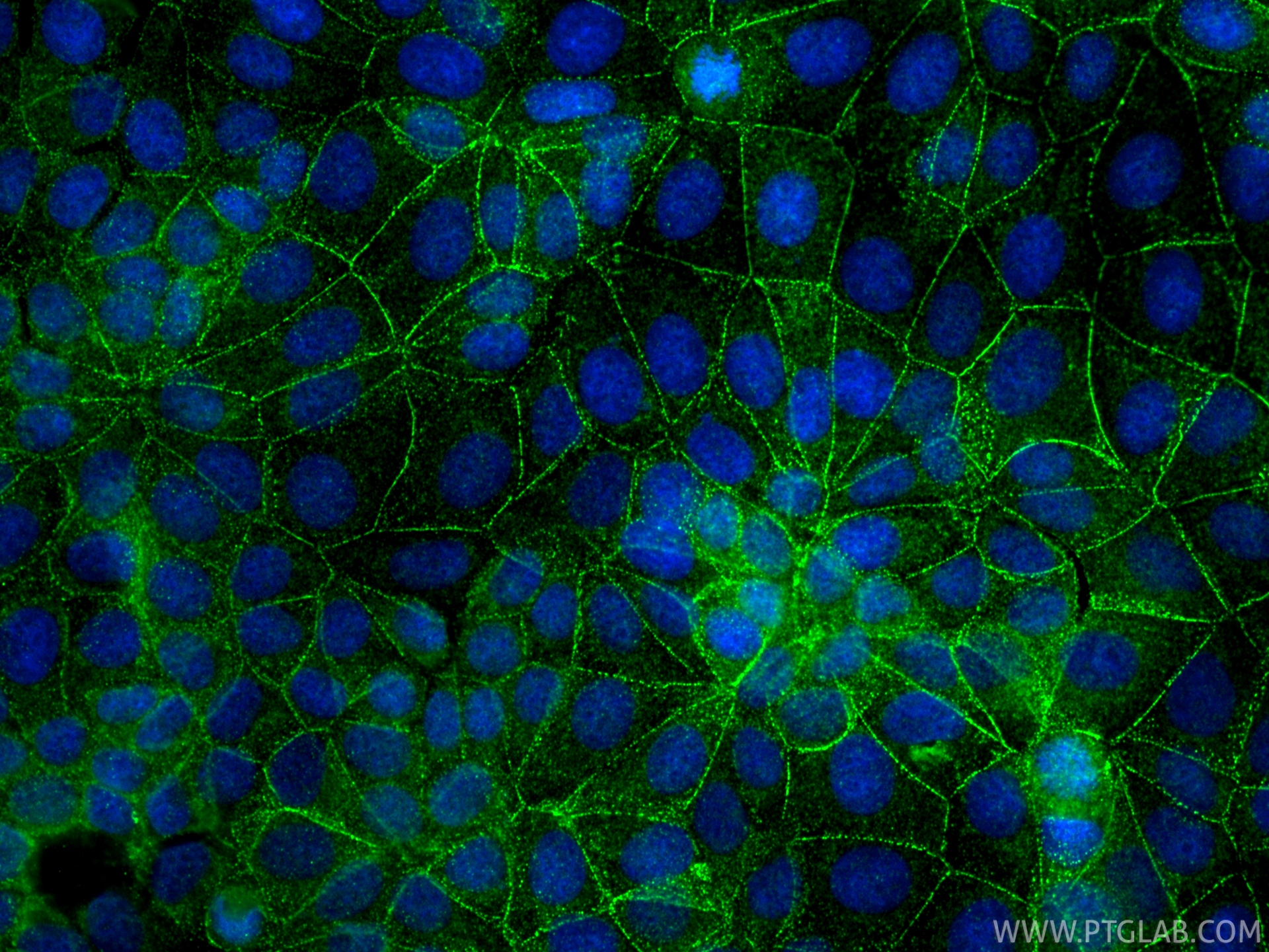 IF Staining of MCF-7 using 84985-1-RR IF Staining of MCF-7 using 84985-1-RR
