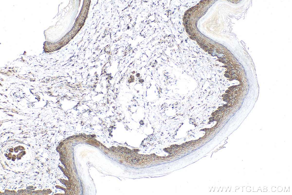 IHC staining of mouse skin using 31154-1-AP