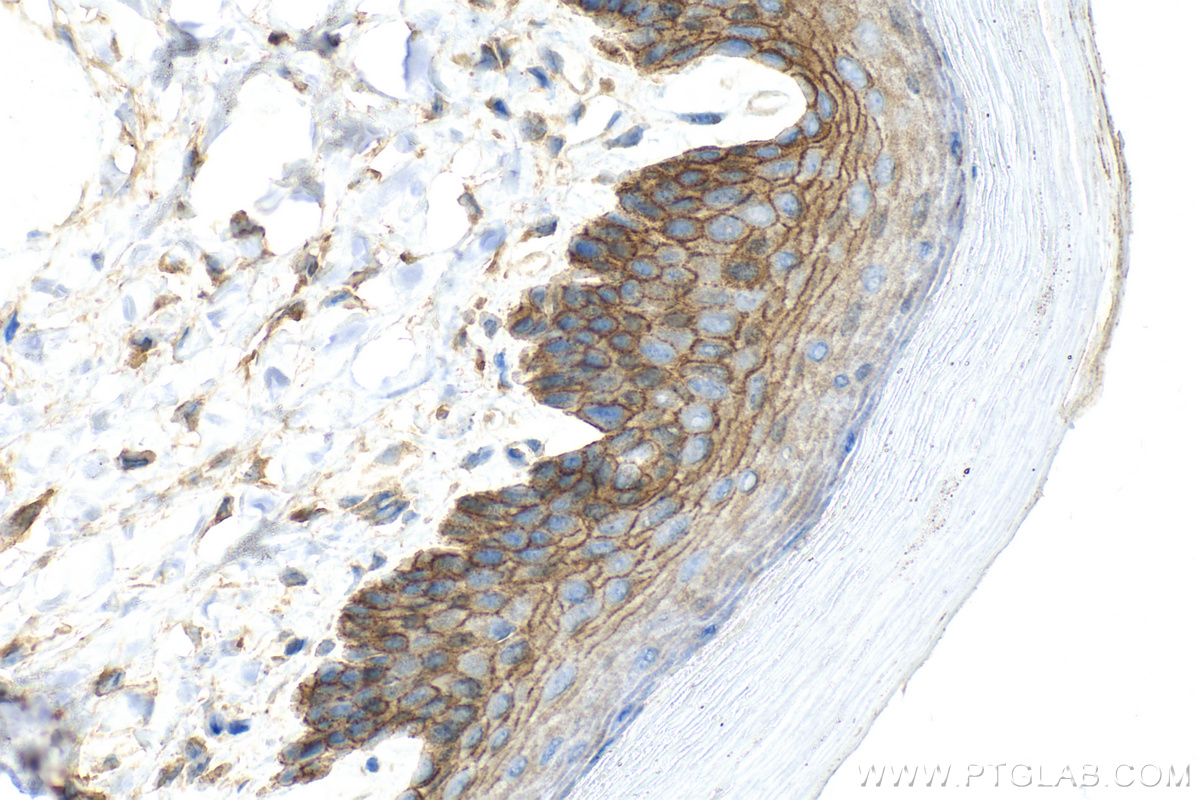 IHC staining of mouse skin using 31154-1-AP