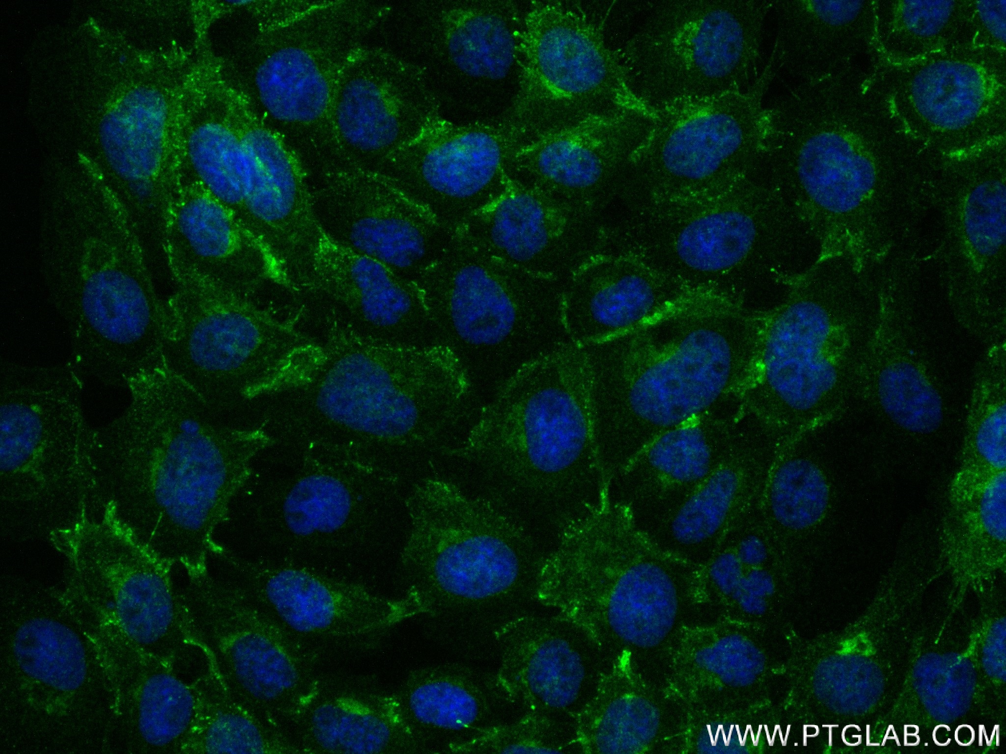 IF Staining of A431 using 83386-5-RR