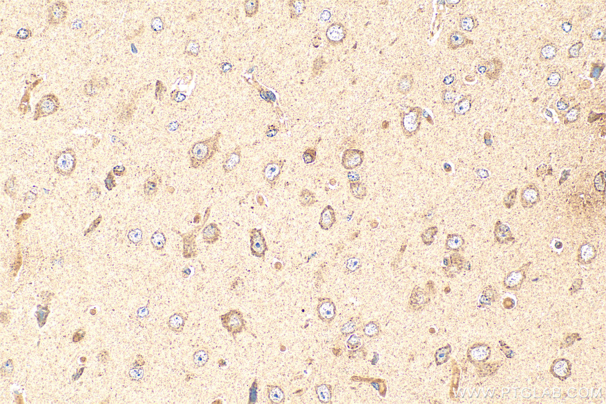 IHC staining of mouse brain using 13439-1-AP (same clone as 13439-1-PBS)