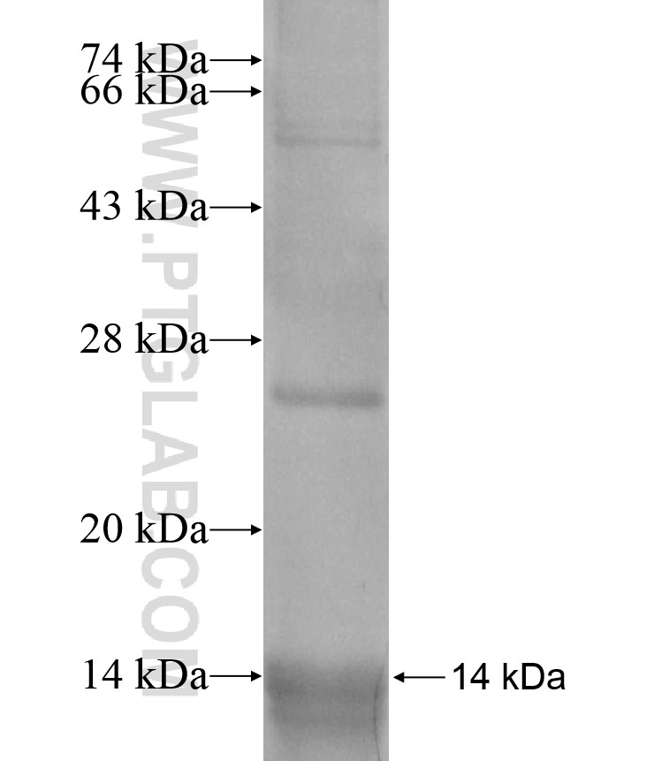 DSCAM fusion protein Ag13672 SDS-PAGE DSCAM fusion protein Ag13672 SDS-PAGE