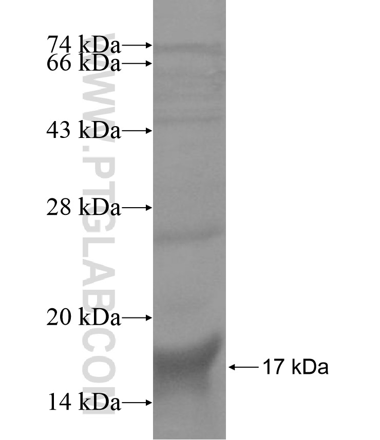 DSCAM fusion protein Ag13693 SDS-PAGE DSCAM fusion protein Ag13693 SDS-PAGE