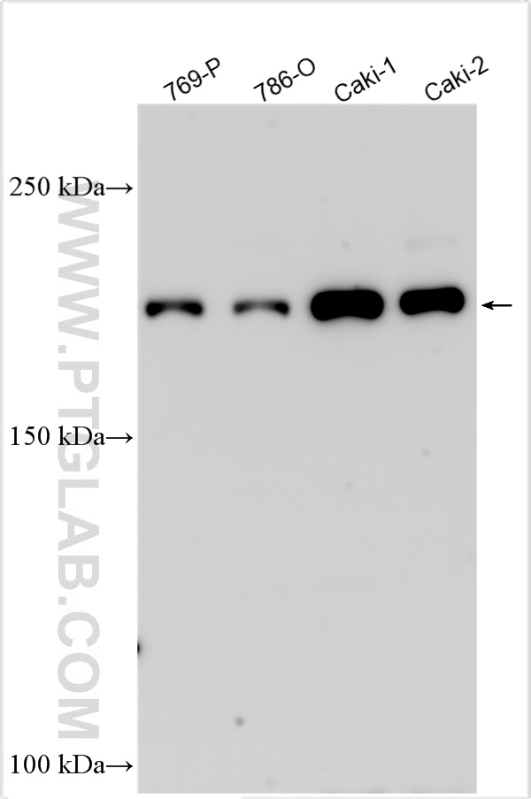 WB analysis using 32634-1-AP