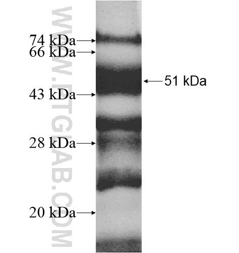 DSCC1 fusion protein Ag12943 SDS-PAGE DSCC1 fusion protein Ag12943 SDS-PAGE