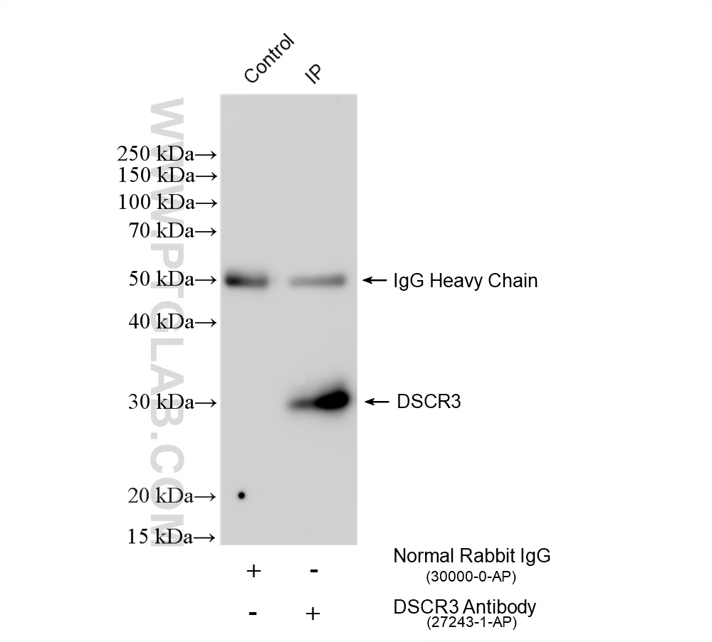 IP experiment of SH-SY5Y using 27243-1-AP