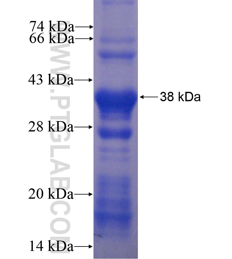 DSE fusion protein Ag16696 SDS-PAGE DSE fusion protein Ag16696 SDS-PAGE