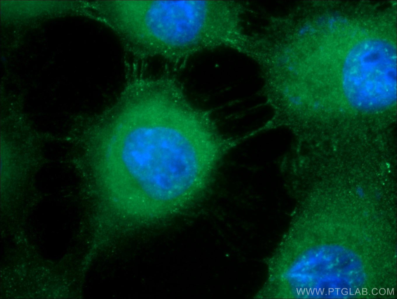 DSG1 (U6) Rabbit mAb main image 0
