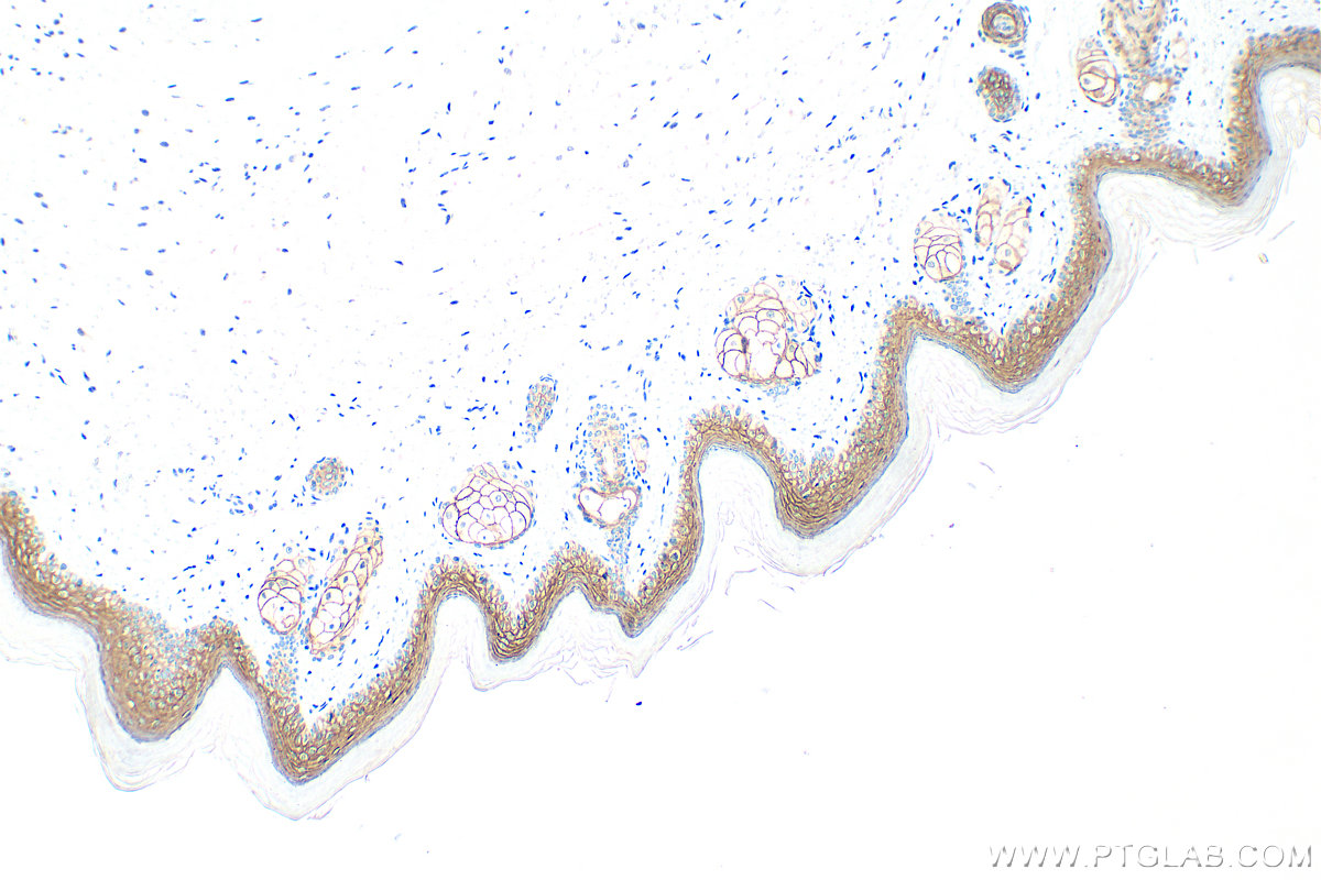 IHC staining of mouse skin using 24587-1-AP