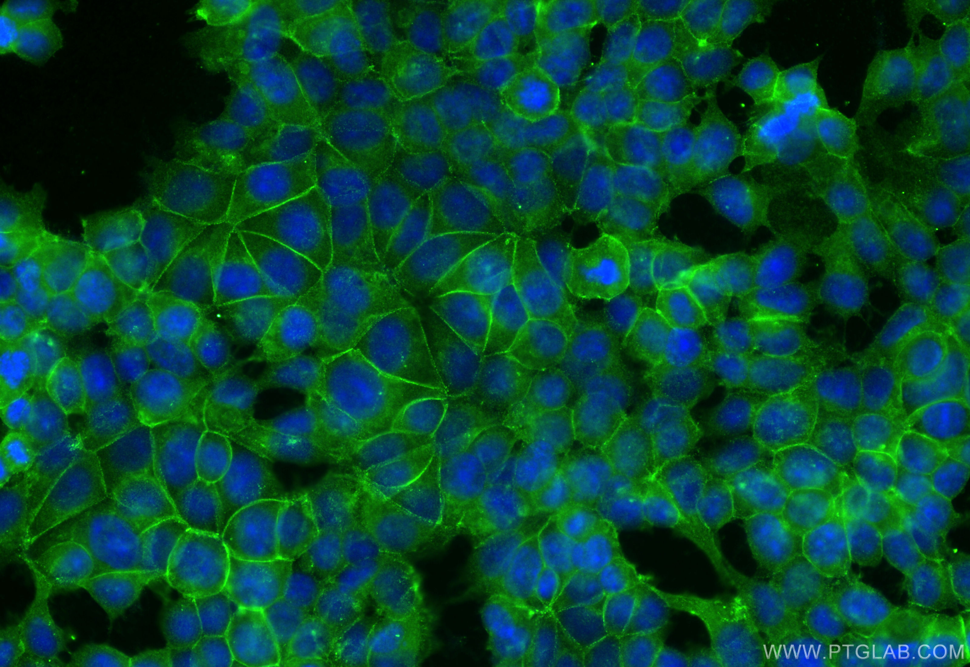 IF Staining of MCF-7 using 21880-1-AP