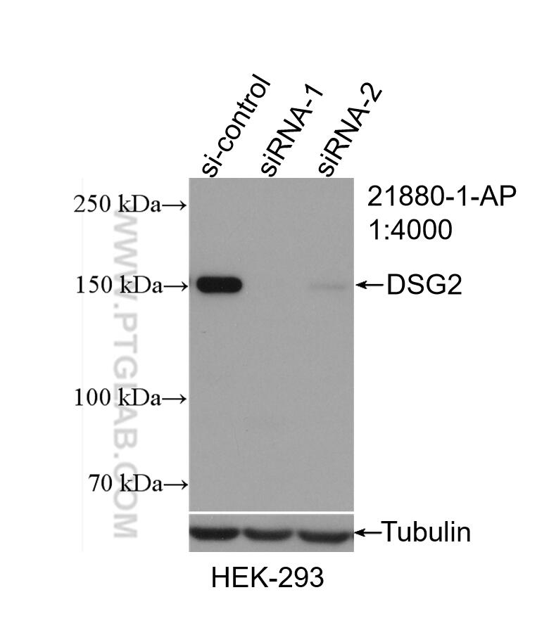 WB analysis of HEK-293 using 21880-1-AP