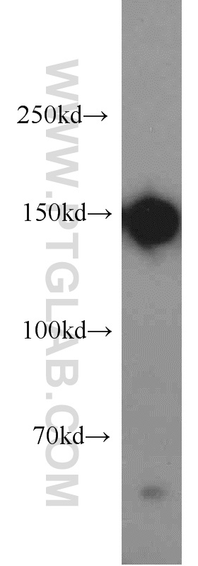 WB analysis of HepG2 using 21880-1-AP