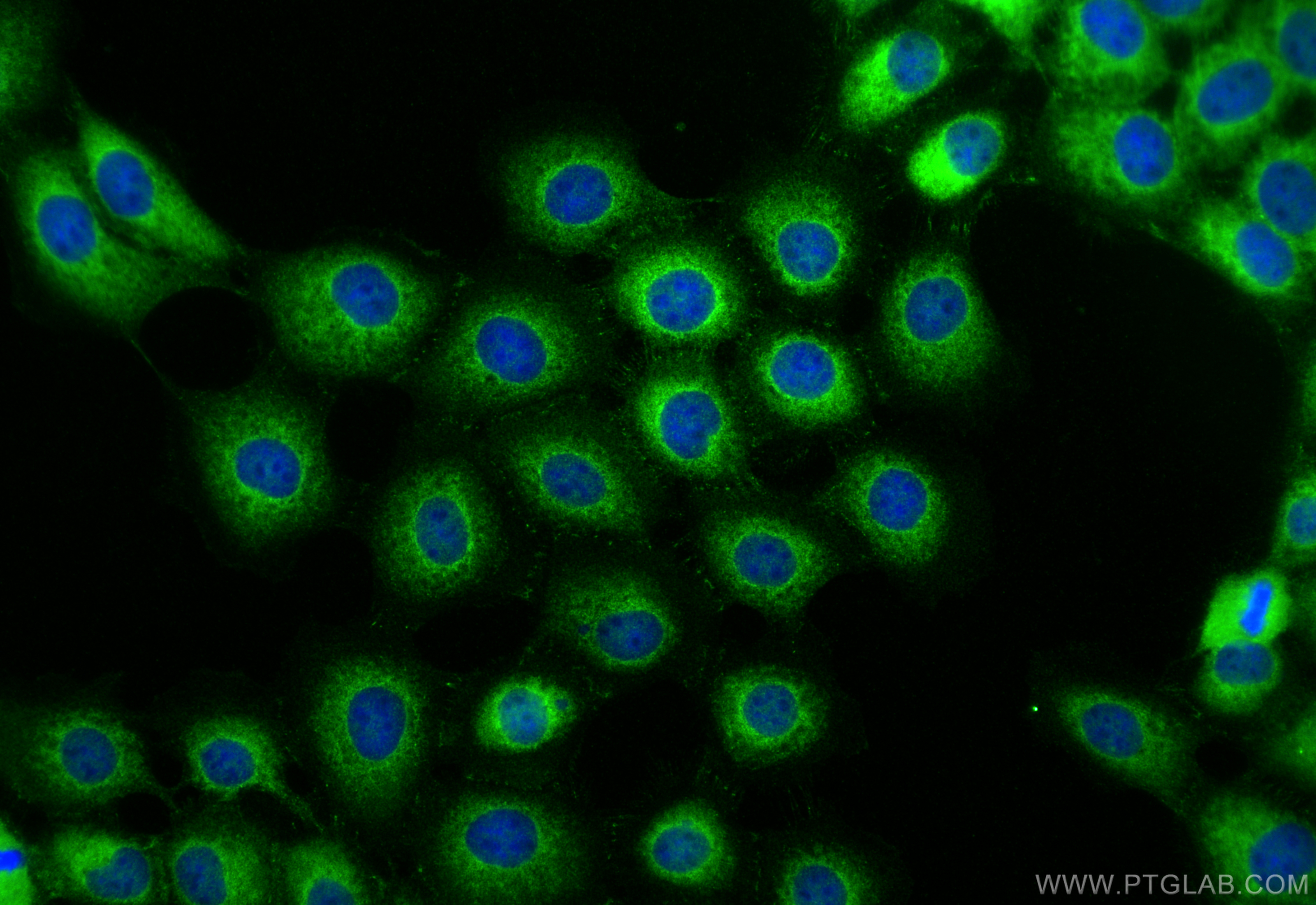 IF Staining of A431 using 29206-1-AP
