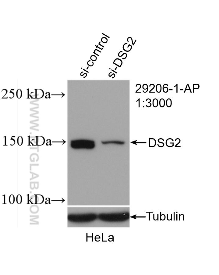 WB analysis of HeLa using 29206-1-AP