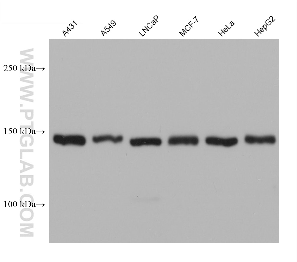 WB analysis using 68515-1-Ig (same clone as 68515-1-PBS)