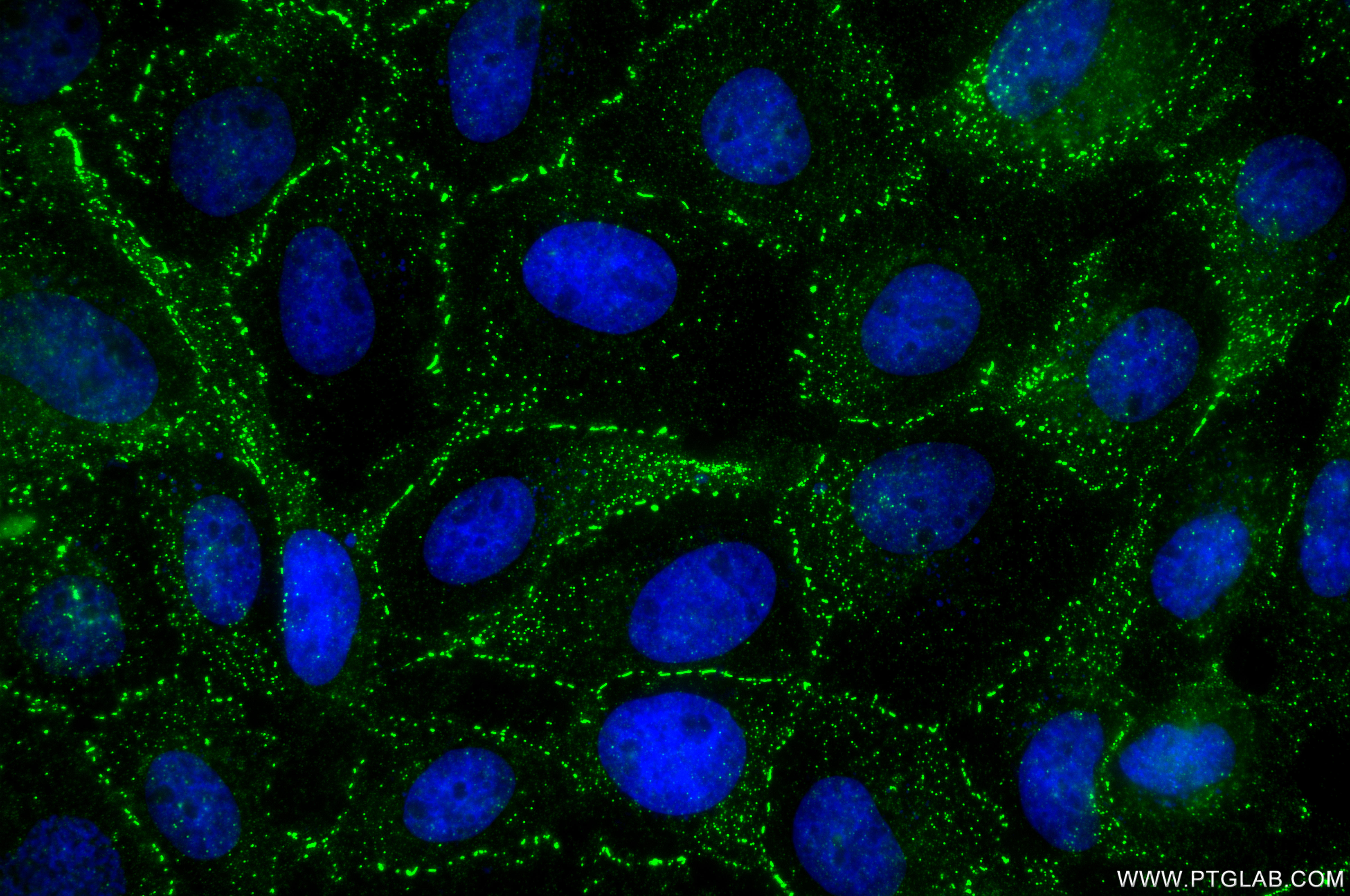 IF Staining of A431 using 87426-1-RR