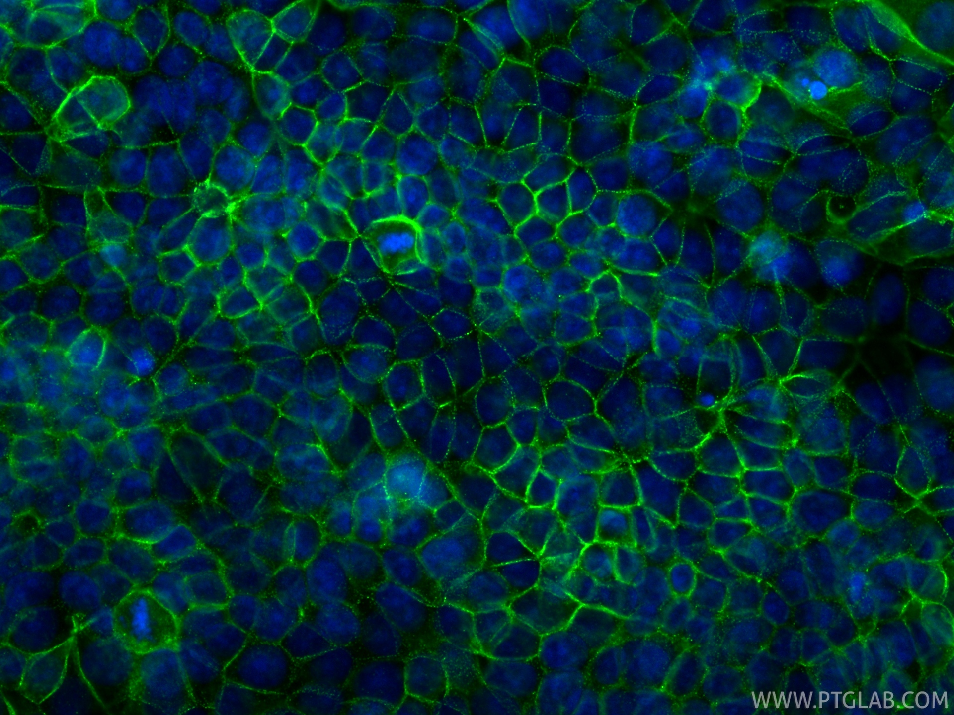 IF Staining of MCF-7 using 87426-1-RR