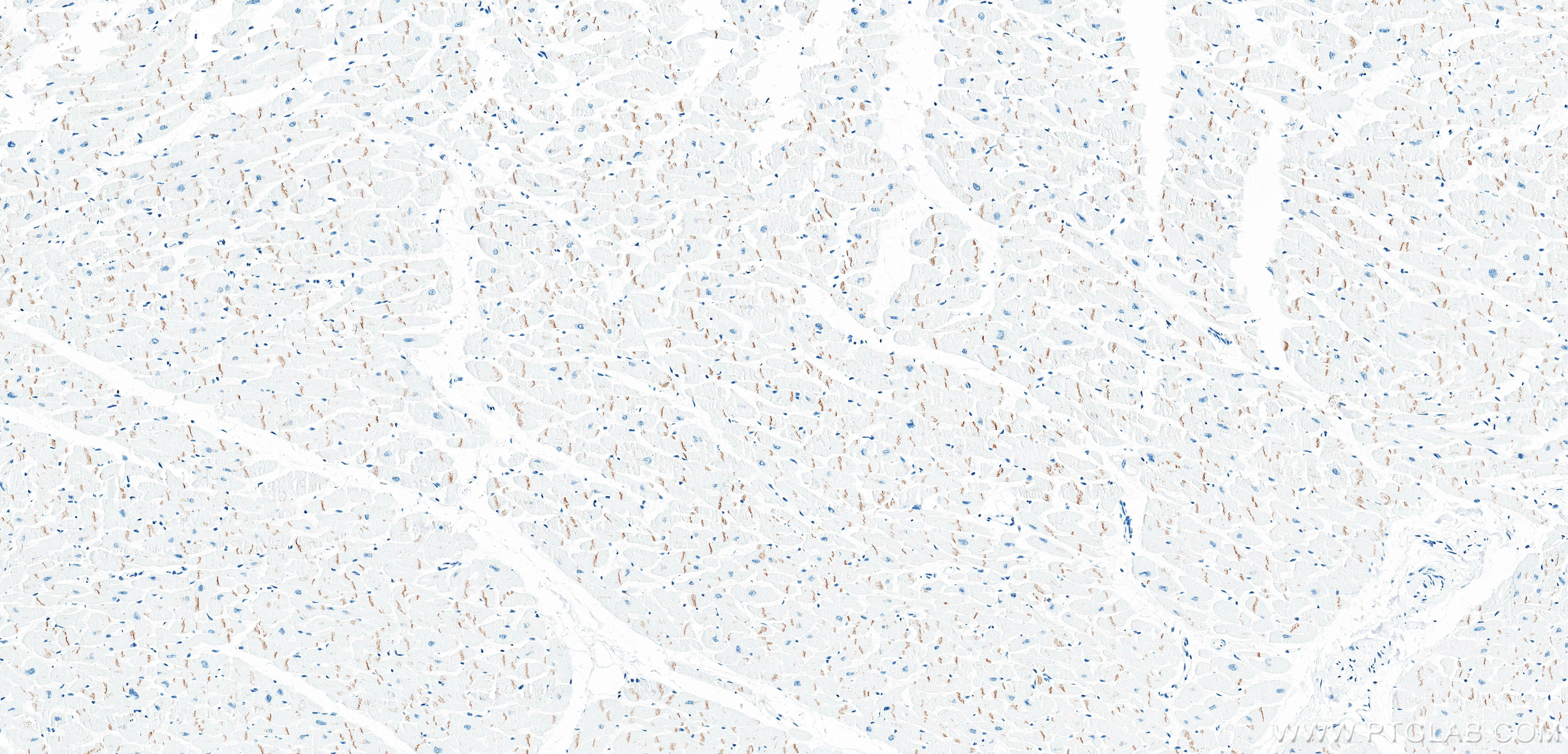 IHC staining of human heart using 87426-1-RR IHC staining of human heart using 87426-1-RR