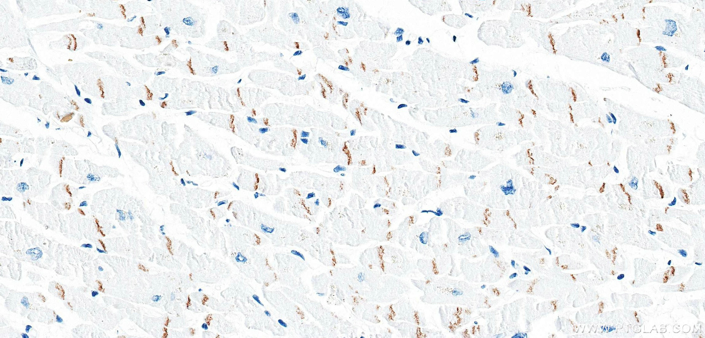 IHC staining of human heart using 87426-1-RR IHC staining of human heart using 87426-1-RR