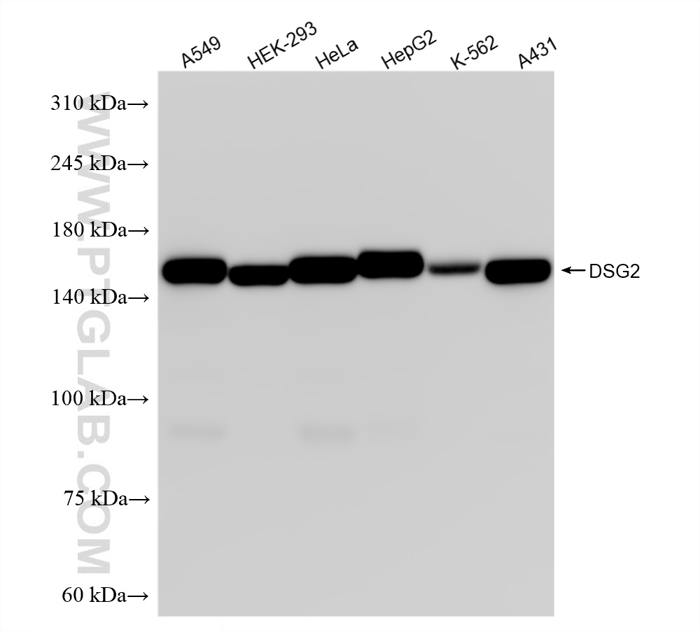 WB analysis using 87426-1-RR