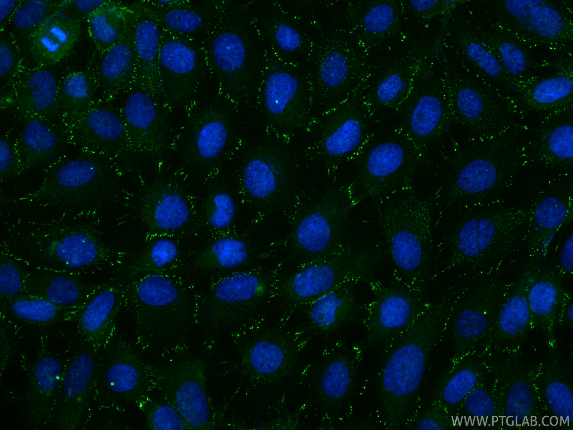 IF Staining of A431 using CL488-87426