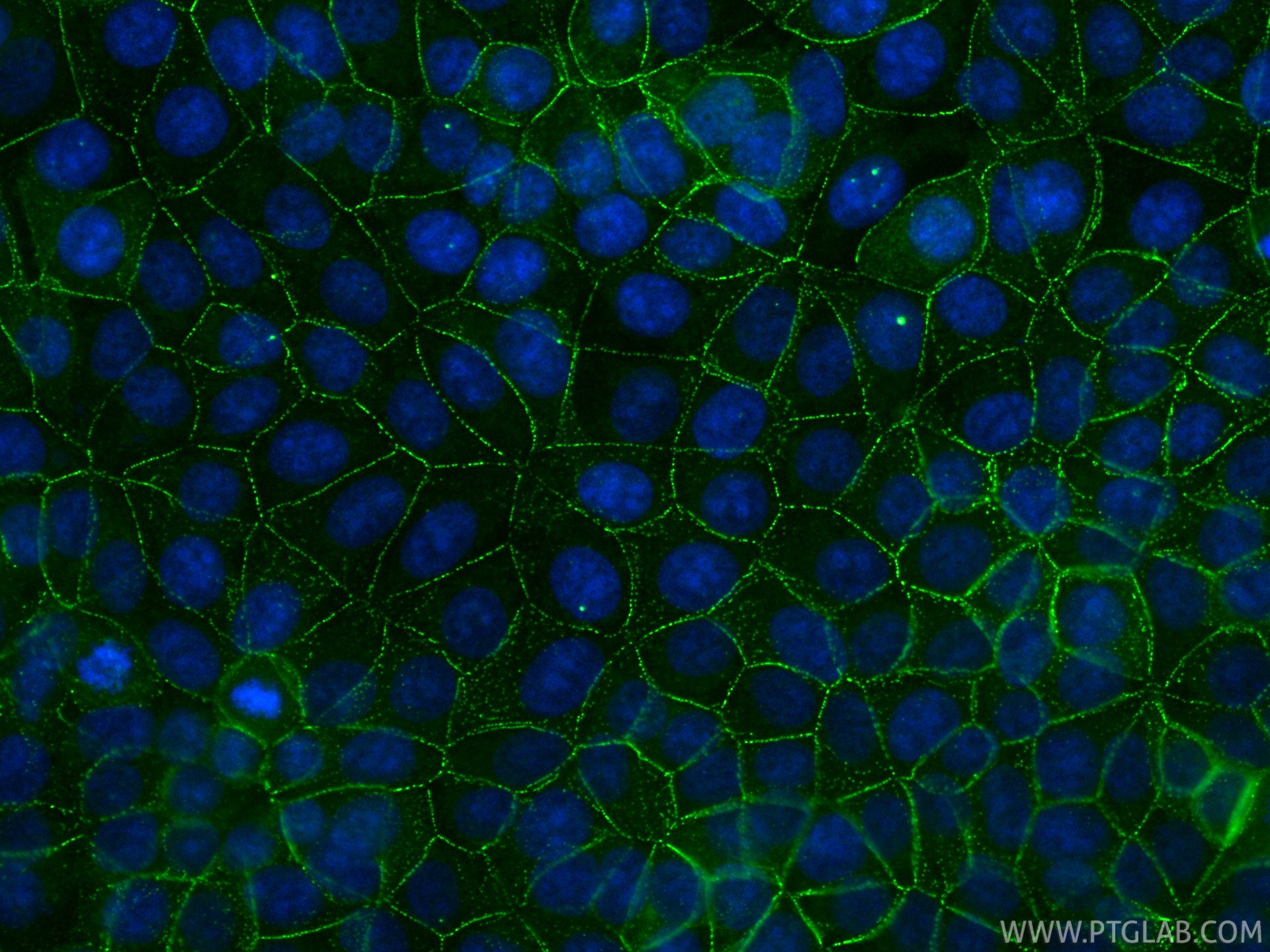 IF Staining of MCF-7 using CL488-87426