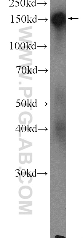 WB analysis of mouse skin using 23087-1-AP