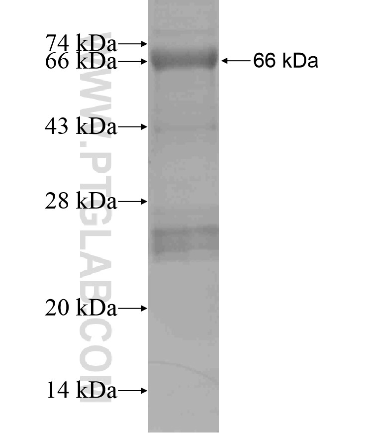 DSP fusion protein Ag18065 SDS-PAGE