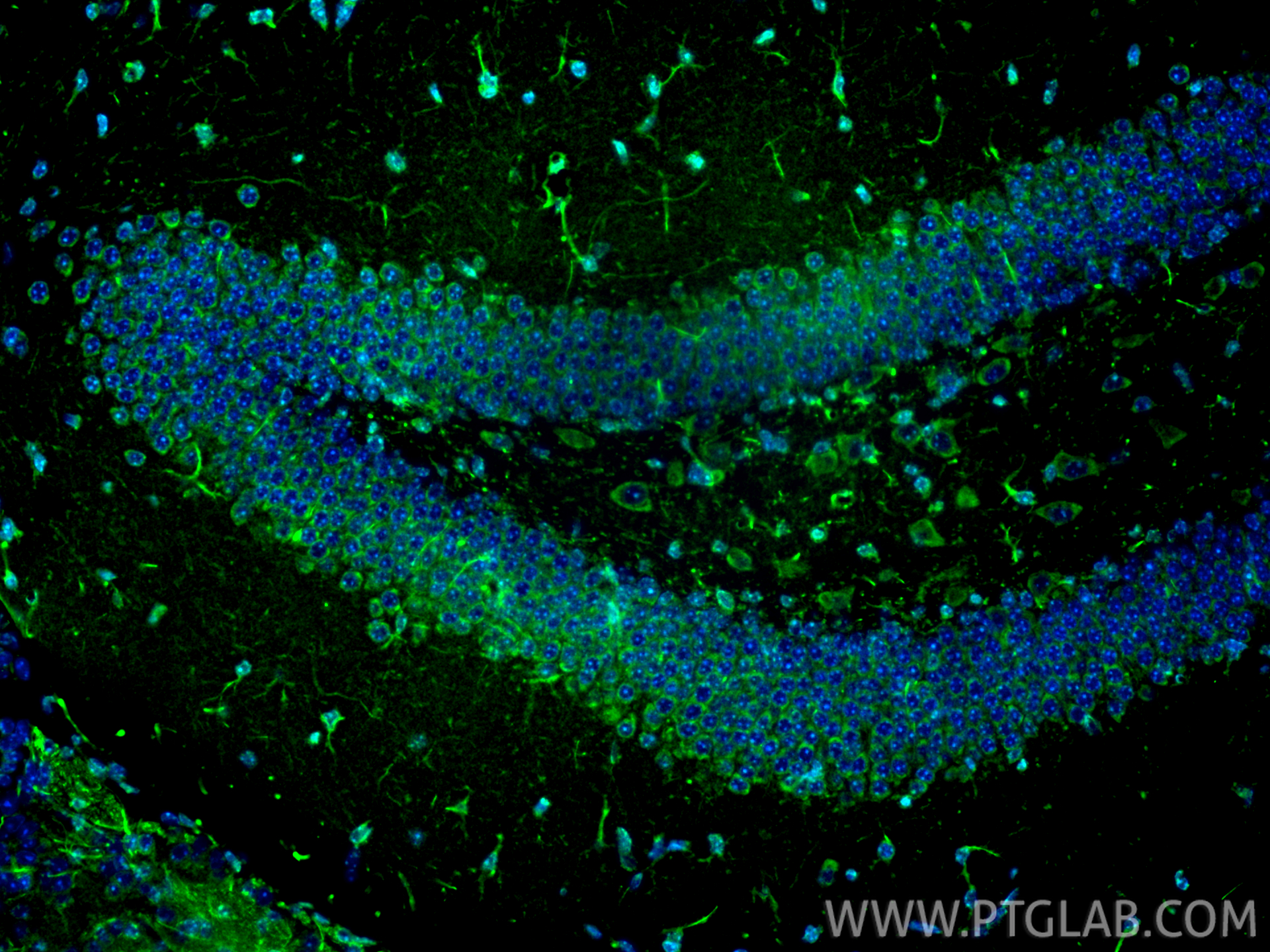 IF Staining of mouse brain using 55396-1-AP