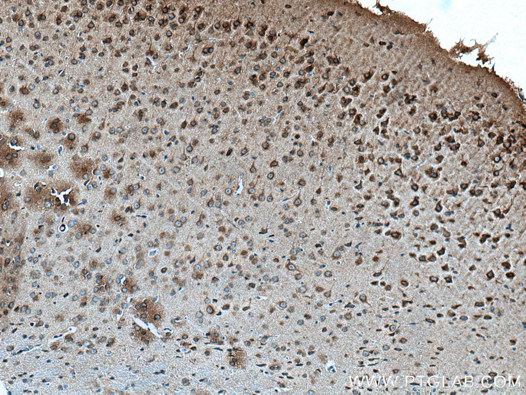 IHC staining of mouse brain using 28438-1-AP