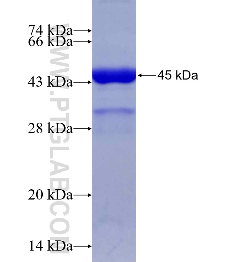 DSTN fusion protein Ag1402 SDS-PAGE