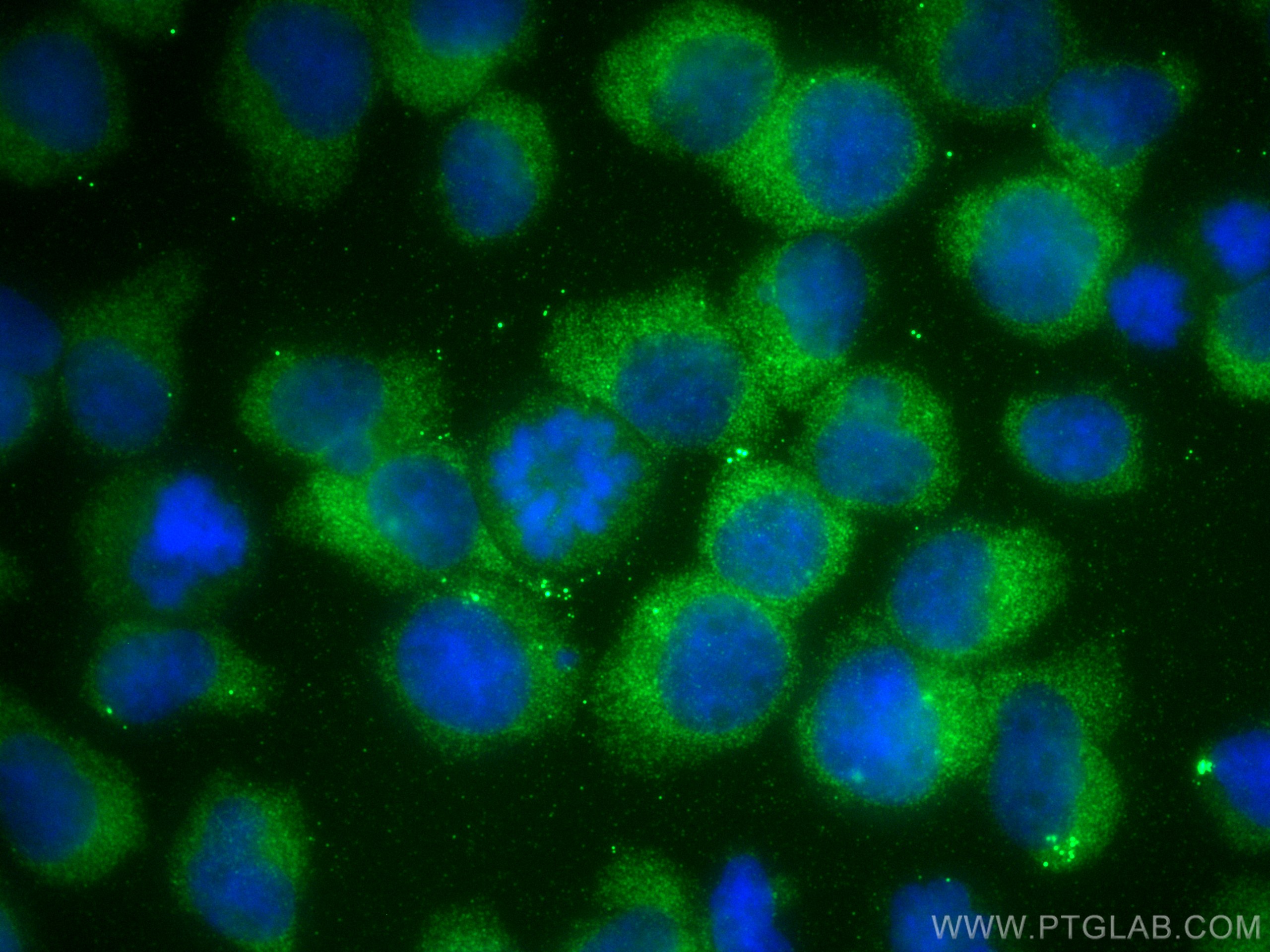 IF Staining of Jurkat using 17480-1-AP