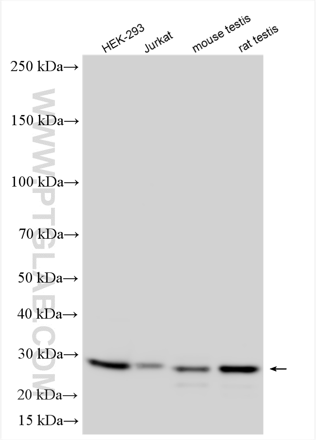 WB analysis using 17480-1-AP WB analysis using 17480-1-AP