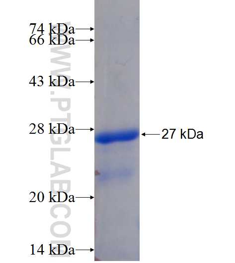 DTD1 fusion protein Ag11634 SDS-PAGE DTD1 fusion protein Ag11634 SDS-PAGE