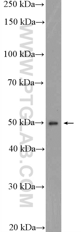 DTNA Polyclonal antibody