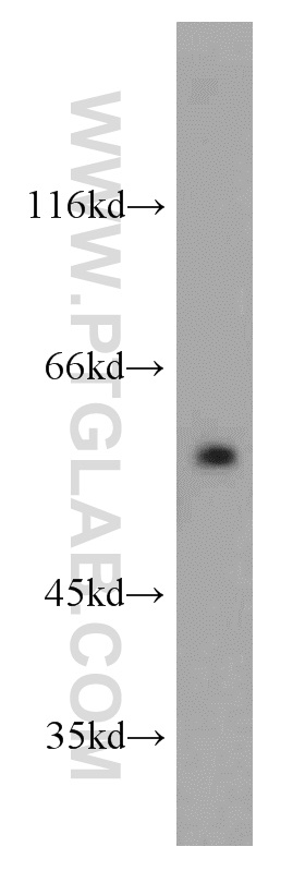 DTNA