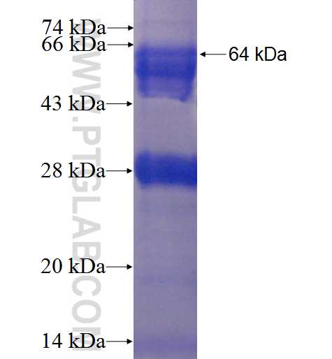 DTNA fusion protein Ag1075 SDS-PAGE