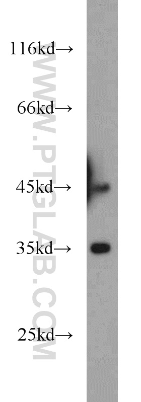 Dysbindin Polyclonal antibody