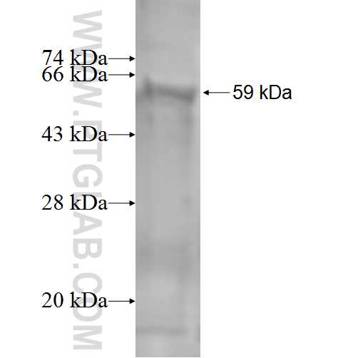 DTX2 fusion protein Ag1050 SDS-PAGE DTX2 fusion protein Ag1050 SDS-PAGE