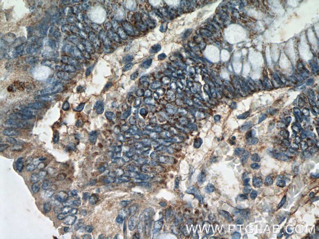 IHC staining of human colon using 25304-1-AP