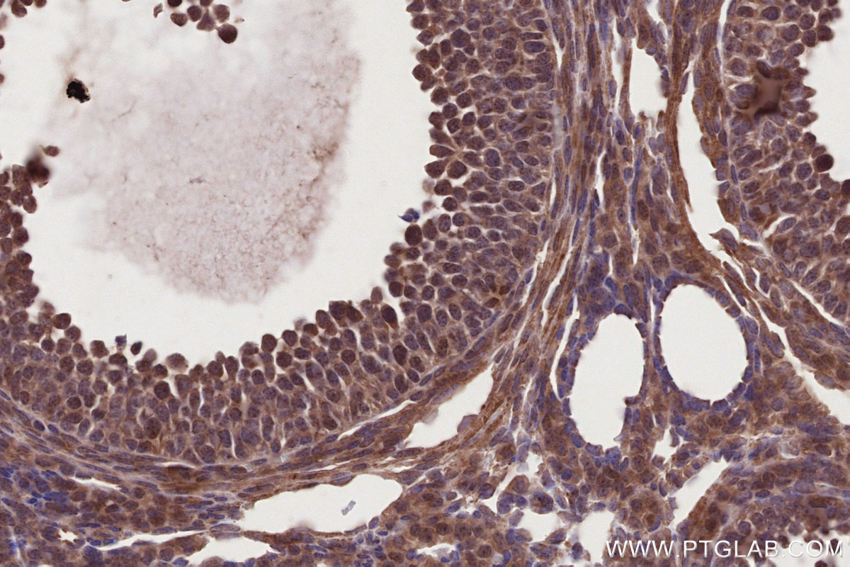 IHC staining of mouse ovary using 11963-1-AP IHC staining of mouse ovary using 11963-1-AP