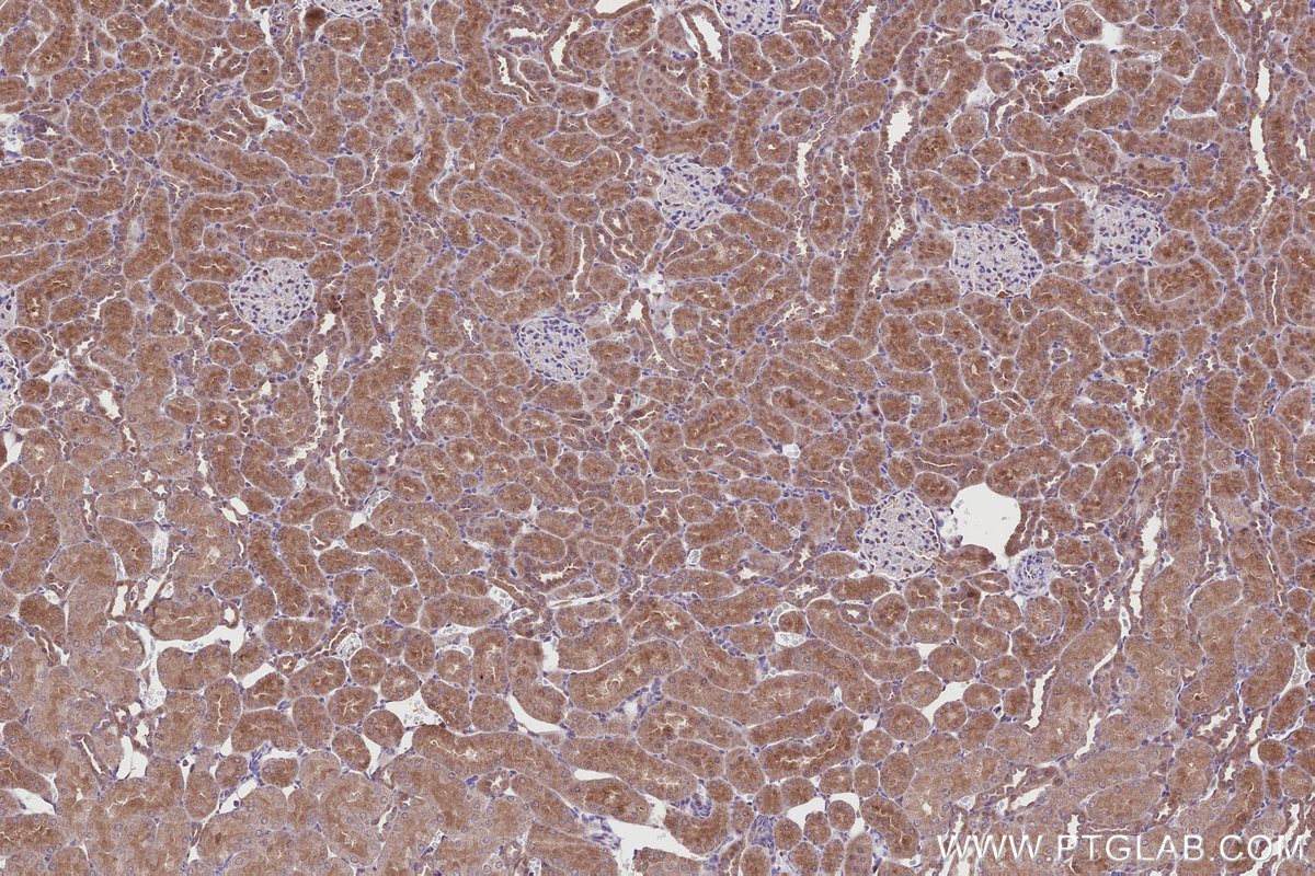 IHC staining of rat kidney using 11963-1-AP IHC staining of rat kidney using 11963-1-AP