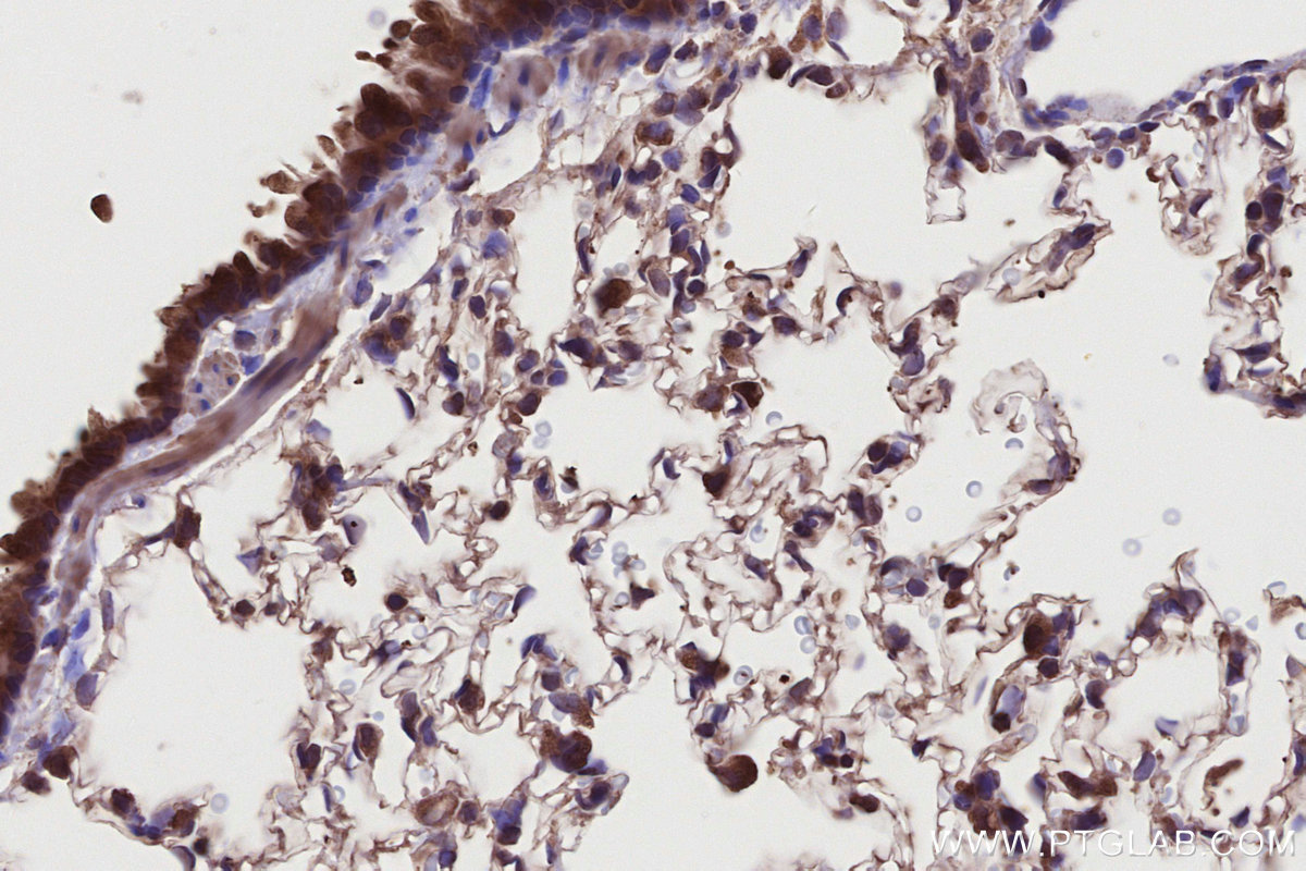 IHC staining of rat lung using 11963-1-AP IHC staining of rat lung using 11963-1-AP